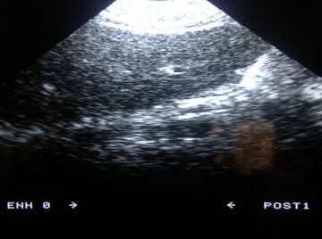 kontron sigma 1 AC live pic sigma 1 AC live pic